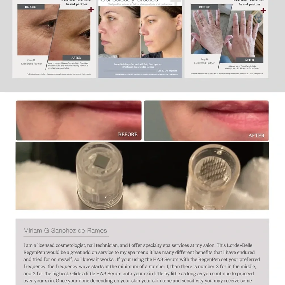 Viral LORDE + BELLE RegenPen- take skincare to a new level!🤩